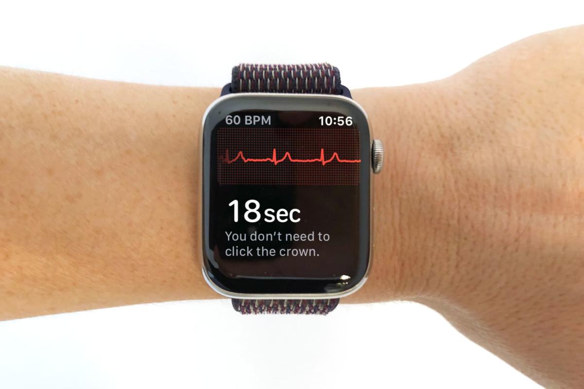 fungsi apple watch